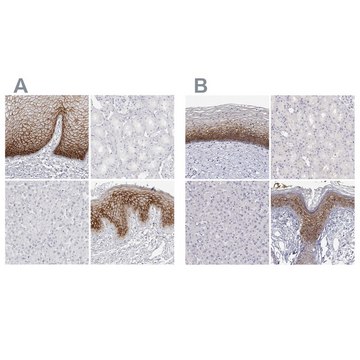 Anti-LY6D antibody produced in rabbit Prestige Antibodies&#174; Powered by Atlas Antibodies, affinity isolated antibody, buffered aqueous glycerol solution