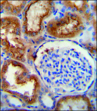 ANTI-SLC5A12 (C-TERM) antibody produced in rabbit IgG fraction of antiserum, buffered aqueous solution