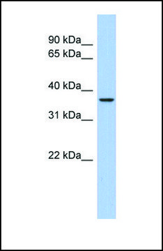 Anti-AQP10 antibody produced in rabbit affinity isolated antibody