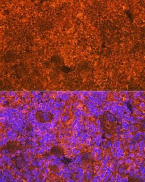 Anti-CD3D antibody produced in rabbit