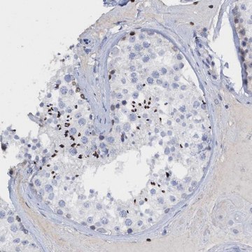 Anti-CBX2 antibody produced in rabbit Prestige Antibodies&#174; Powered by Atlas Antibodies, affinity isolated antibody, buffered aqueous glycerol solution