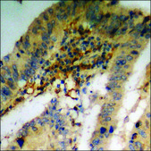 Anti-phospho-PLCG1 (pTyr783) antibody produced in rabbit affinity isolated antibody