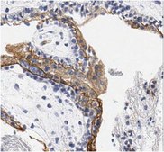 Anti-Cytokeratin 18 Antibody, clone CK2 (Ascites Free) clone CK2, 1 mg/mL, from mouse