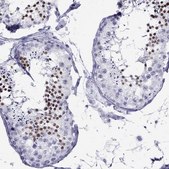 Anti-LYAR antibody produced in rabbit Prestige Antibodies® Powered by Atlas Antibodies, affinity isolated antibody, buffered aqueous glycerol solution