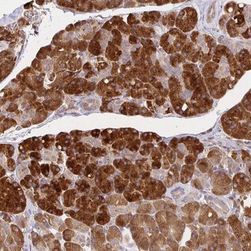 Anti-IRAK1 antibody produced in rabbit Prestige Antibodies&#174; Powered by Atlas Antibodies, affinity isolated antibody, buffered aqueous glycerol solution