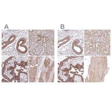 Anti-FCHO2 antibody produced in rabbit Prestige Antibodies&#174; Powered by Atlas Antibodies, affinity isolated antibody, buffered aqueous glycerol solution