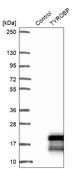 Anti-TYROBP antibody produced in rabbit Prestige Antibodies® Powered by Atlas Antibodies, affinity isolated antibody, buffered aqueous glycerol solution