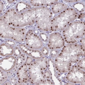 Anti-PRMT6 antibody produced in rabbit Prestige Antibodies&#174; Powered by Atlas Antibodies, affinity isolated antibody, buffered aqueous glycerol solution