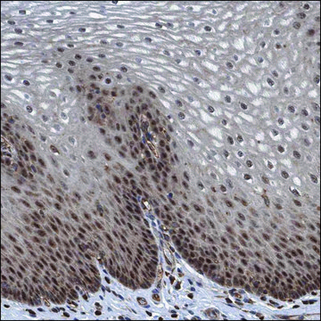 Anti-ESRP1 antibody produced in rabbit Prestige Antibodies&#174; Powered by Atlas Antibodies, affinity isolated antibody, buffered aqueous glycerol solution, Ab2