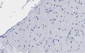 Anti-Fibroblast Antibody, clone TE-7 ZooMAb® Mouse Monoclonal recombinant, expressed in HEK 293 cells