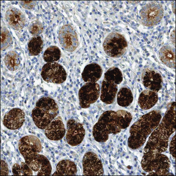 Anti-TRPA1 antibody produced in rabbit Prestige Antibodies&#174; Powered by Atlas Antibodies, affinity isolated antibody, buffered aqueous glycerol solution