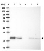 Anti-MRPL12 antibody produced in rabbit Prestige Antibodies® Powered by Atlas Antibodies, affinity isolated antibody, buffered aqueous glycerol solution, Ab1