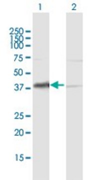 Anti-HDGF antibody produced in mouse purified immunoglobulin, buffered aqueous solution