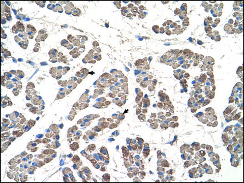 Anti-GCDH antibody produced in rabbit IgG fraction of antiserum