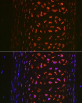 Anti- MMP13 antibody produced in rabbit