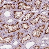 Anti-SLC5A12 antibody produced in rabbit Prestige Antibodies® Powered by Atlas Antibodies, affinity isolated antibody, buffered aqueous glycerol solution