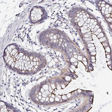 Anti-ARL4D antibody produced in rabbit Prestige Antibodies&#174; Powered by Atlas Antibodies, affinity isolated antibody, buffered aqueous glycerol solution