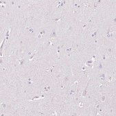 Anti-HSD17B2 antibody produced in rabbit Prestige Antibodies® Powered by Atlas Antibodies, affinity isolated antibody, buffered aqueous glycerol solution