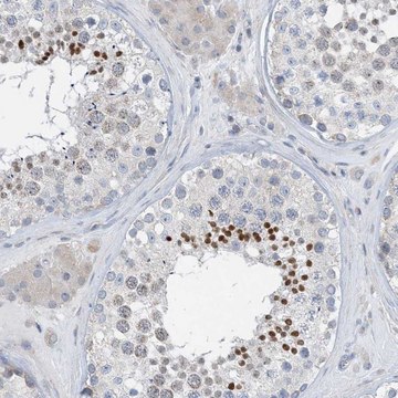 Anti-BTBD8 antibody produced in rabbit Prestige Antibodies&#174; Powered by Atlas Antibodies, affinity isolated antibody, buffered aqueous glycerol solution