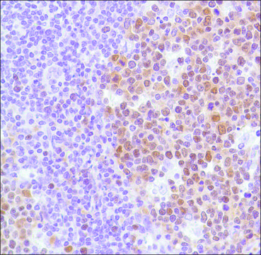 Anti-BCL-6 antibody, Rabbit monoclonal clone SP155, recombinant, expressed in proprietary host, affinity isolated antibody