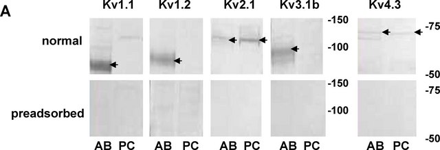 Anti-Potassium Channel Kv3.1b Antibody Chemicon&#174;, from rabbit