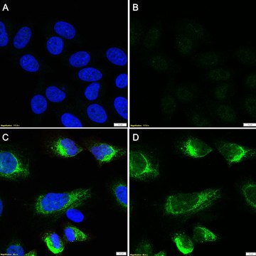 Anti-RFP/DsRed Antibody, clone 1E11 ZooMAb&#174; Rabbit Monoclonal recombinant, expressed in HEK 293 cells