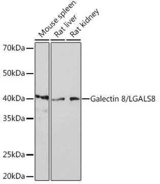 Anti-Galectin 8/LGALS8 Antibody, clone 7M9Q9, Rabbit Monoclonal