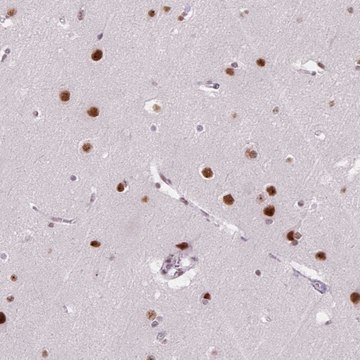 Anti-C2orf82 antibody produced in rabbit Prestige Antibodies&#174; Powered by Atlas Antibodies, affinity isolated antibody, buffered aqueous glycerol solution