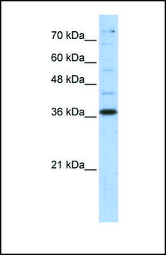 Anti-GAPDH antibody produced in rabbit affinity isolated antibody