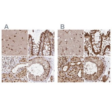 Anti-GLYR1 antibody produced in rabbit Prestige Antibodies&#174; Powered by Atlas Antibodies, affinity isolated antibody, buffered aqueous glycerol solution