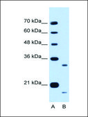 Anti-CCPG1 antibody produced in rabbit affinity isolated antibody