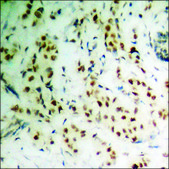 Anti-phospho-SREBP-1 (pSer439) antibody produced in rabbit affinity isolated antibody
