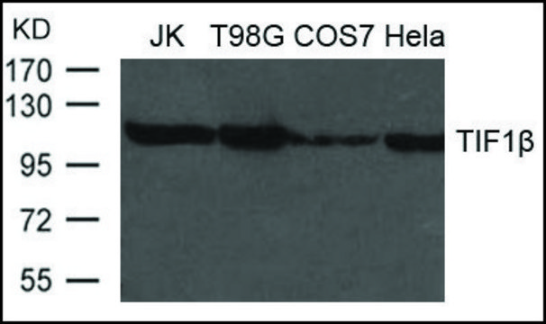 Anti-TIF1&#946; antibody produced in rabbit affinity isolated antibody