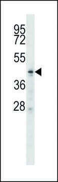 ANTI-ZDHHC6 (C-TERM) antibody produced in rabbit IgG fraction of antiserum, buffered aqueous solution