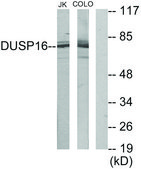 Anti-DUSP16 antibody produced in rabbit affinity isolated antibody