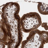 Anti-RAB3GAP2 antibody produced in rabbit Prestige Antibodies® Powered by Atlas Antibodies, affinity isolated antibody, buffered aqueous glycerol solution, Ab2