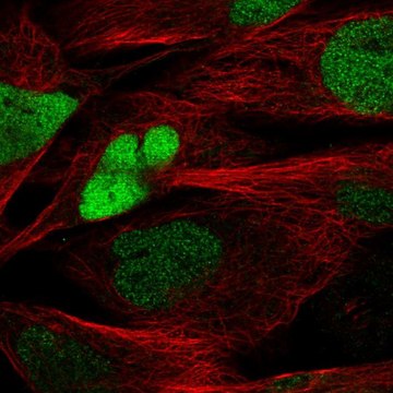 Anti-SOX8 antibody produced in rabbit affinity isolated antibody