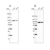 Anti-TF antibody produced in rabbit Ab2, Prestige Antibodies&#174; Powered by Atlas Antibodies, affinity isolated antibody, buffered aqueous glycerol solution