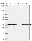 Anti-CAMLG antibody produced in rabbit Prestige Antibodies® Powered by Atlas Antibodies, affinity isolated antibody, buffered aqueous glycerol solution