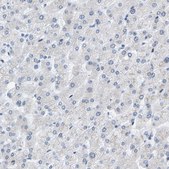 Anti-KRT76 antibody produced in rabbit Prestige Antibodies® Powered by Atlas Antibodies, affinity isolated antibody, buffered aqueous glycerol solution, Ab1
