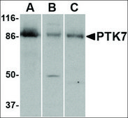Anti-PTK7 antibody produced in rabbit affinity isolated antibody, buffered aqueous solution