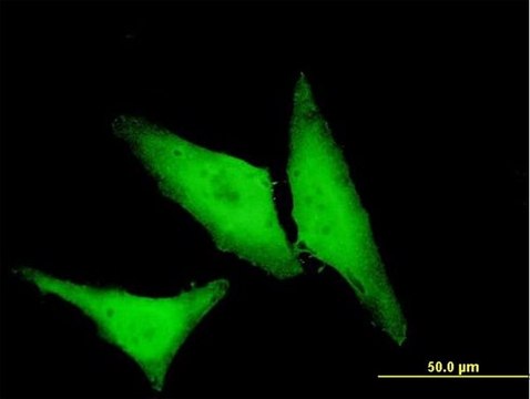 Monoclonal Anti-HSPB1 antibody produced in mouse clone 3G3, purified immunoglobulin, buffered aqueous solution