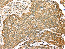 Anti-MAPK7 affinity isolated antibody