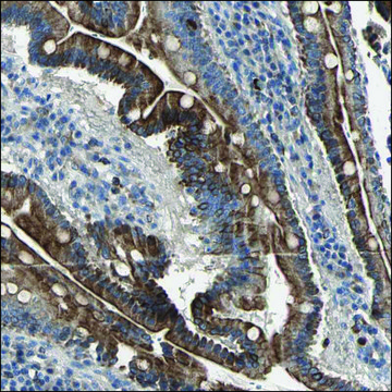 Anti-KIF1A antibody produced in rabbit Ab1, Prestige Antibodies&#174; Powered by Atlas Antibodies, affinity isolated antibody, buffered aqueous glycerol solution