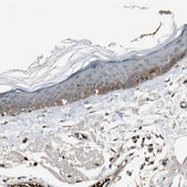 Anti-MST1R antibody produced in rabbit Ab1, Prestige Antibodies® Powered by Atlas Antibodies, affinity isolated antibody, buffered aqueous glycerol solution