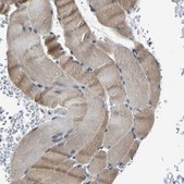 Anti-MYO18A antibody produced in rabbit Prestige Antibodies® Powered by Atlas Antibodies, affinity isolated antibody, buffered aqueous glycerol solution, Ab2