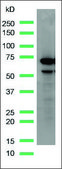 Anti-Alpha-Fetoprotein antibody, Rabbit monoclonal recombinant, expressed in proprietary host, clone SP154, affinity isolated antibody