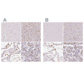 Anti-MRC1 antibody produced in rabbit Prestige Antibodies® Powered by Atlas Antibodies, affinity isolated antibody, buffered aqueous glycerol solution