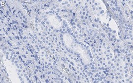 Anti-Selenoprotein P Antibody, clone 2G23 ZooMAb® Rabbit Monoclonal recombinant, expressed in HEK 293 cells