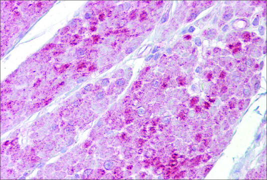 Anti-OAS1, (N-terminal) antibody produced in rabbit affinity isolated antibody